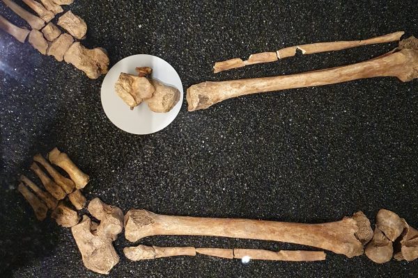 Dissociative identity disorder visual data 4